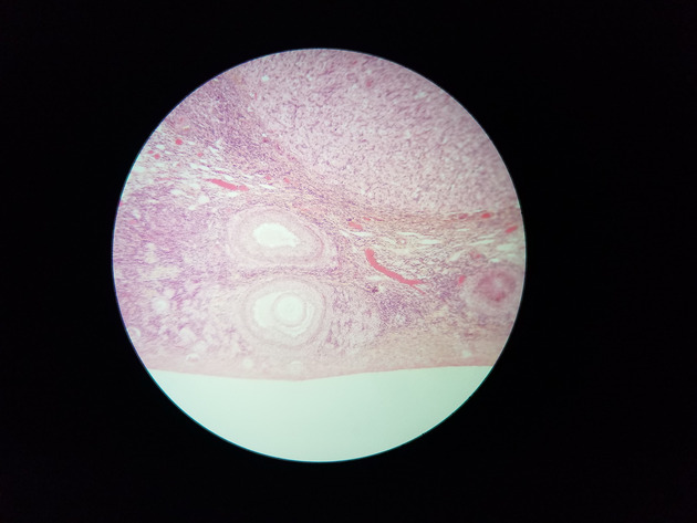 Ovary Slides - Ovary 005 100X